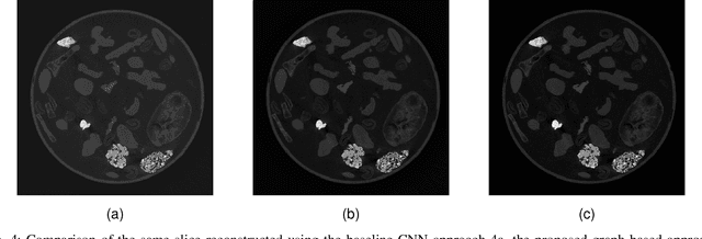 Figure 4 for Improving the Generalisation of Learned Reconstruction Frameworks