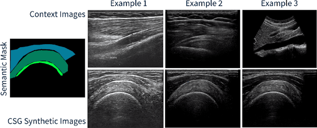 Figure 4 for CSG: A Context-Semantic Guided Diffusion Approach in De Novo Musculoskeletal Ultrasound Image Generation