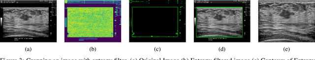 Figure 3 for Enhancing AI Diagnostics: Autonomous Lesion Masking via Semi-Supervised Deep Learning