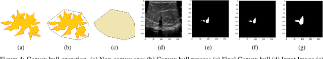 Figure 4 for Enhancing AI Diagnostics: Autonomous Lesion Masking via Semi-Supervised Deep Learning