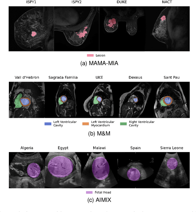 Figure 4 for Federated nnU-Net for Privacy-Preserving Medical Image Segmentation