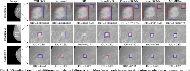Figure 3 for Multi-Head Feature Pyramid Networks for Breast Mass Detection