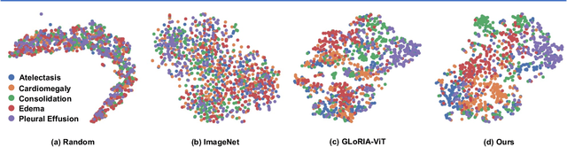 Figure 3 for Enhancing medical vision-language contrastive learning via inter-matching relation modelling