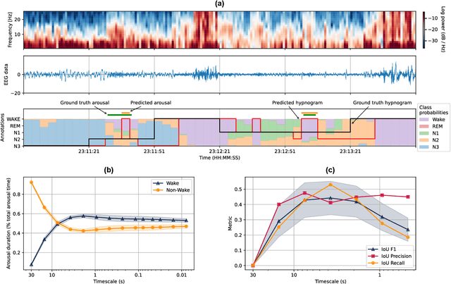 Figure 3 for AnySleep: a channel-agnostic deep learning system for high-resolution sleep staging in multi-center cohorts