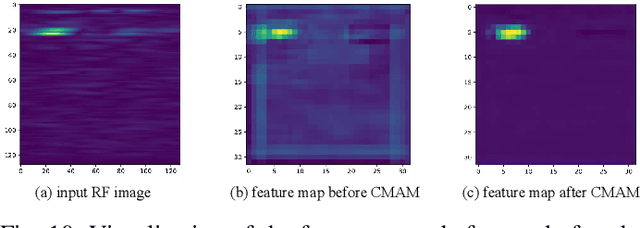 Figure 2 for Mask-RadarNet: Enhancing Transformer With Spatial-Temporal Semantic Context for Radar Object Detection in Autonomous Driving