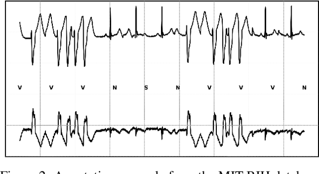 Figure 3 for A Systematic Review of ECG Arrhythmia Classification: Adherence to Standards, Fair Evaluation, and Embedded Feasibility