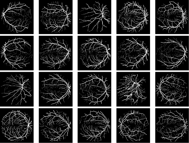 Figure 1 for Efficient Image Segmentation Framework with Difference of Anisotropic and Isotropic Total Variation for Blur and Poisson Noise Removal