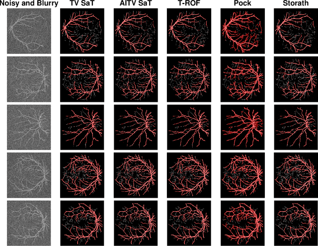 Figure 3 for Efficient Image Segmentation Framework with Difference of Anisotropic and Isotropic Total Variation for Blur and Poisson Noise Removal