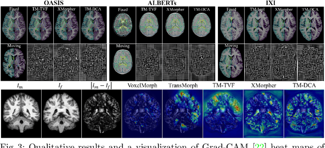 Figure 4 for Deformable Cross-Attention Transformer for Medical Image Registration