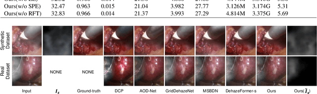 Figure 4 for Attention-Aware Laparoscopic Image Desmoking Network with Lightness Embedding and Hybrid Guided Embedding