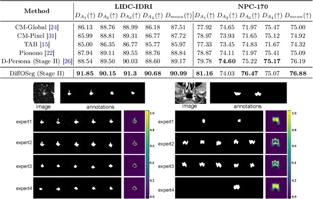 Figure 3 for DiffOSeg: Omni Medical Image Segmentation via Multi-Expert Collaboration Diffusion Model