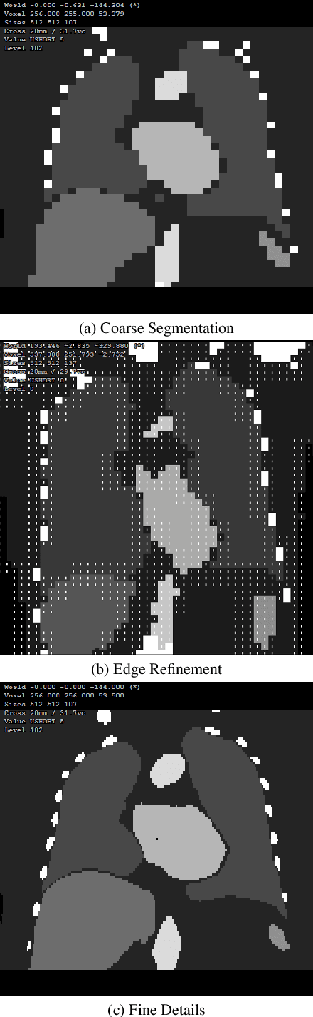 Figure 4 for Real Time Multi Organ Classification on Computed Tomography Images
