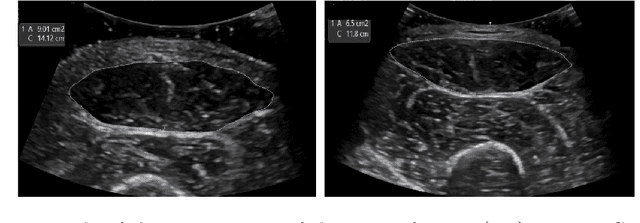 Figure 1 for Automatic retrieval of corresponding US views in longitudinal examinations