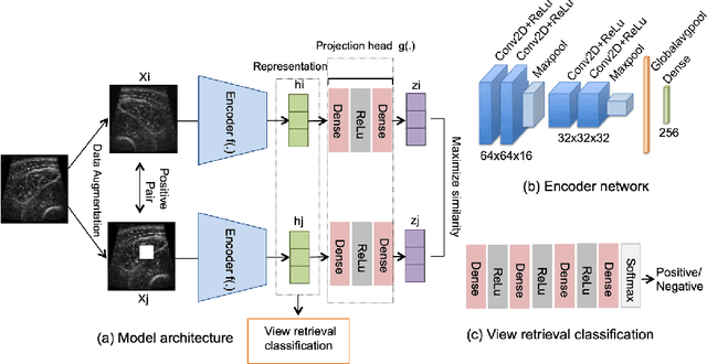 Figure 3 for Automatic retrieval of corresponding US views in longitudinal examinations