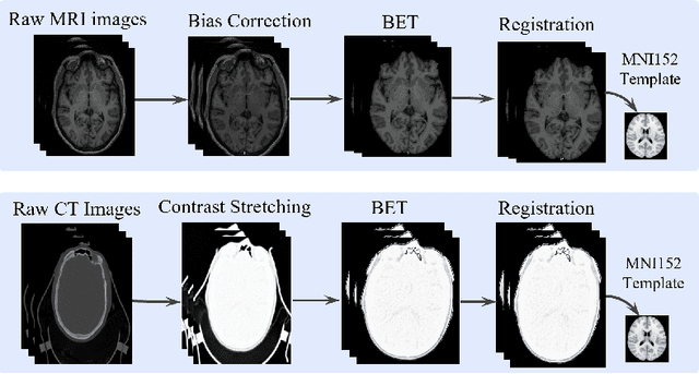 Figure 1 for Unmasking Dementia Detection by Masking Input Gradients: A JSM Approach to Model Interpretability and Precision
