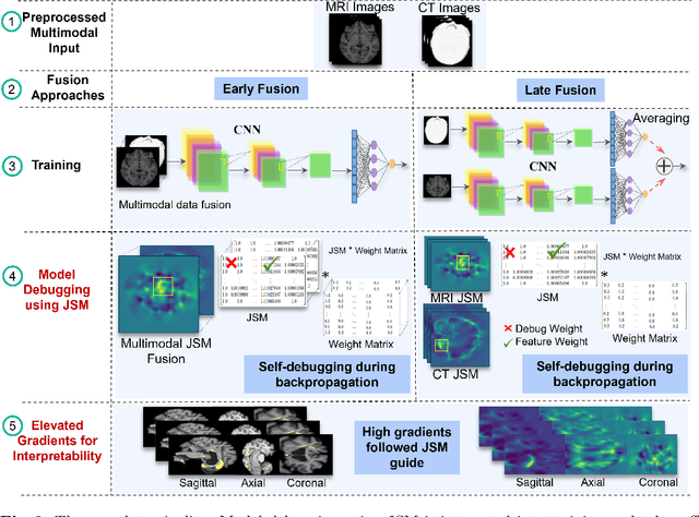 Figure 3 for Unmasking Dementia Detection by Masking Input Gradients: A JSM Approach to Model Interpretability and Precision