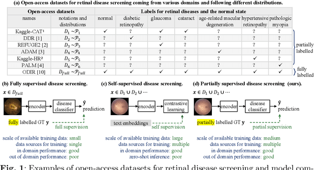 Figure 1 for PSScreen V2: Partially Supervised Multiple Retinal Disease Screening