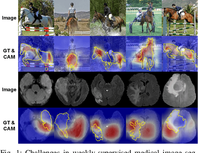 Figure 1 for WeakMedSAM: Weakly-Supervised Medical Image Segmentation via SAM with Sub-Class Exploration and Prompt Affinity Mining