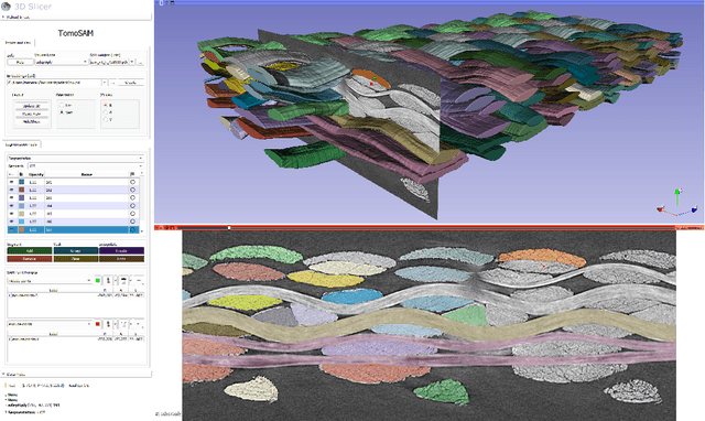 Figure 2 for TomoSAM: a 3D Slicer extension using SAM for tomography segmentation
