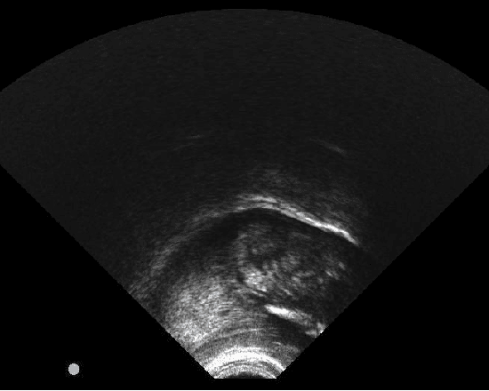 Figure 3 for A small vocabulary database of ultrasound image sequences of vocal tract dynamics