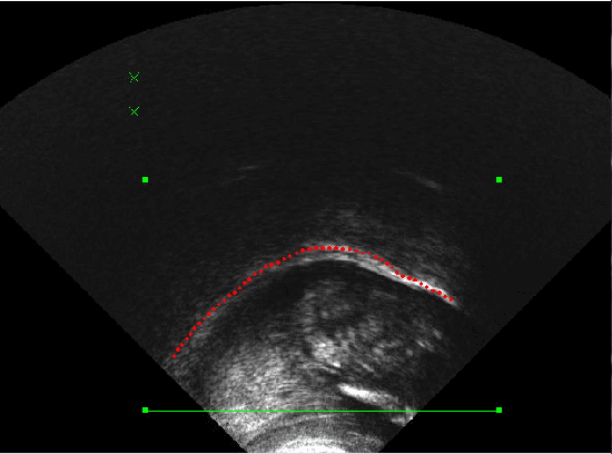 Figure 4 for A small vocabulary database of ultrasound image sequences of vocal tract dynamics