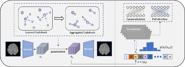 Figure 3 for Unsupervised Anomaly Detection with Local-Sensitive VQVAE and Global-Sensitive Transformers