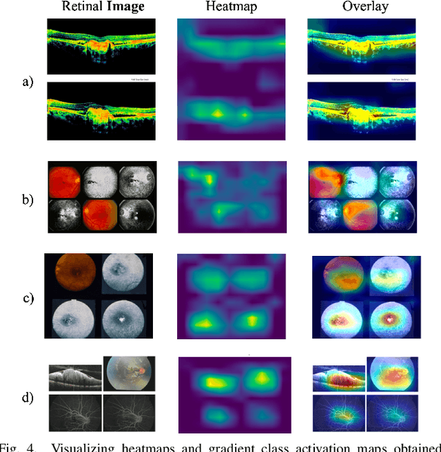 Figure 4 for GCS-M3VLT: Guided Context Self-Attention based Multi-modal Medical Vision Language Transformer for Retinal Image Captioning