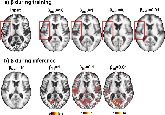 Figure 2 for Unsupervised Analysis of Alzheimer's Disease Signatures using 3D Deformable Autoencoders