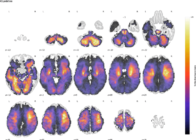 Figure 4 for Generalizable automated ischaemic stroke lesion segmentation with vision transformers