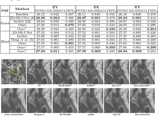 Figure 2 for Reference-Free Isotropic 3D EM Reconstruction using Diffusion Models