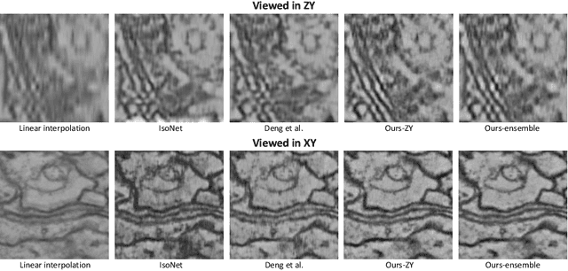 Figure 3 for Reference-Free Isotropic 3D EM Reconstruction using Diffusion Models