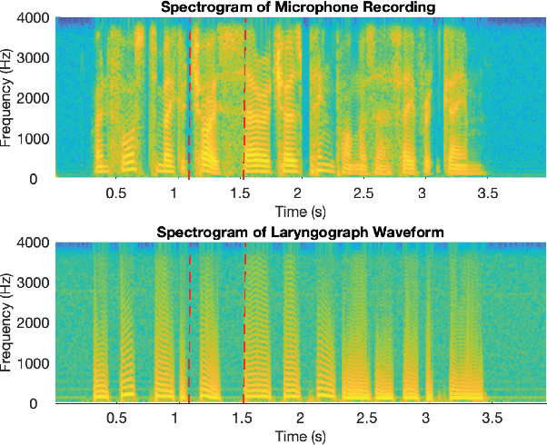 Figure 1 for Leveraging Laryngograph Data for Robust Voicing Detection in Speech