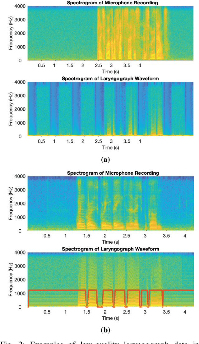 Figure 2 for Leveraging Laryngograph Data for Robust Voicing Detection in Speech