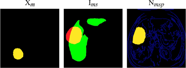 Figure 3 for Mask-guided Data Augmentation for Multiparametric MRI Generation with a Rare Hepatocellular Carcinoma