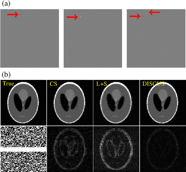 Figure 4 for Deep Image prior with StruCtUred Sparsity for dynamic MRI reconstruction