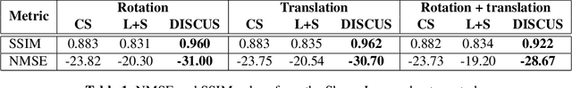 Figure 2 for Deep Image prior with StruCtUred Sparsity for dynamic MRI reconstruction
