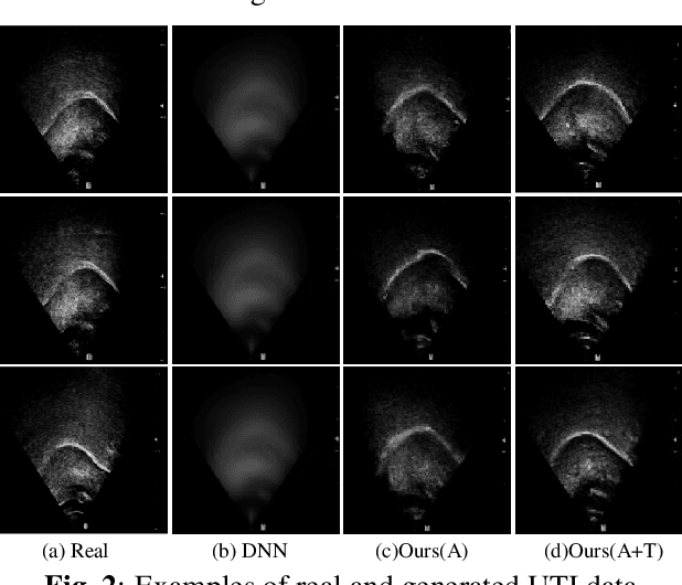 Figure 4 for An Audio-textual Diffusion Model For Converting Speech Signals Into Ultrasound Tongue Imaging Data