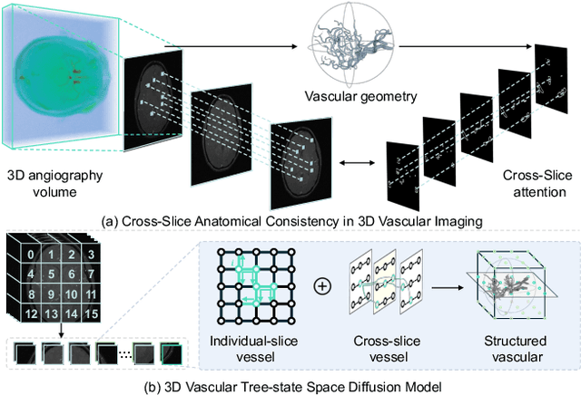 Figure 1 for VasTSD: Learning 3D Vascular Tree-state Space Diffusion Model for Angiography Synthesis