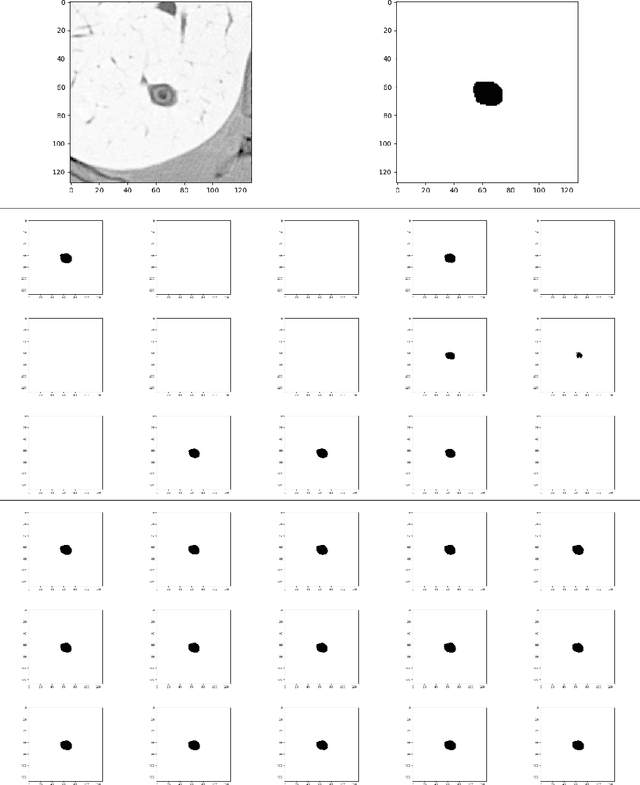 Figure 4 for Probabilistic U-Net with Kendall Shape Spaces for Geometry-Aware Segmentations of Images