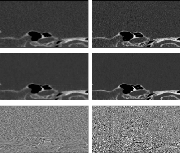 Figure 1 for Photon-counting CT using a Conditional Diffusion Model for Super-resolution and Texture-preservation