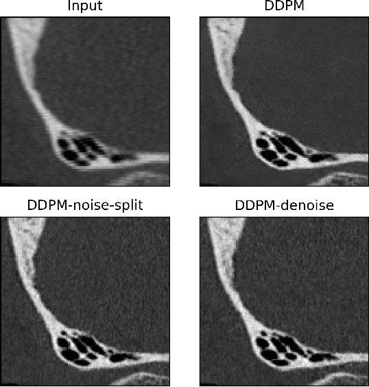Figure 2 for Photon-counting CT using a Conditional Diffusion Model for Super-resolution and Texture-preservation