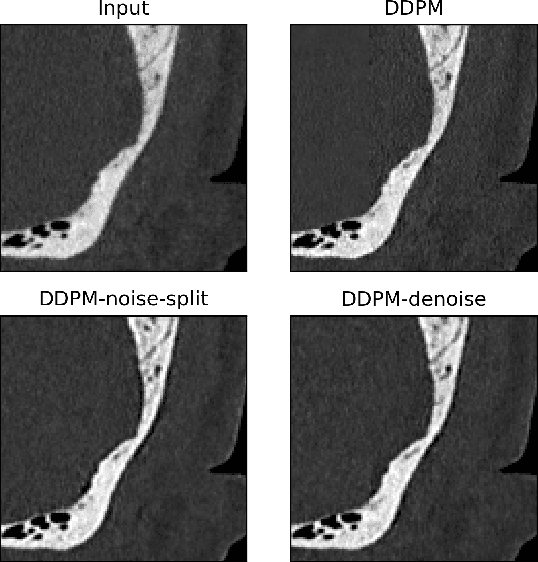 Figure 3 for Photon-counting CT using a Conditional Diffusion Model for Super-resolution and Texture-preservation