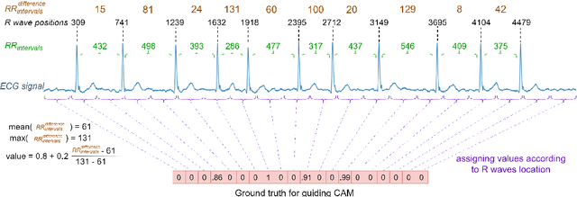 Figure 1 for EXGnet: a single-lead explainable-AI guided multiresolution network with train-only quantitative features for trustworthy ECG arrhythmia classification