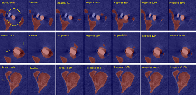 Figure 3 for Semi-Supervised Segmentation via Embedding Matching