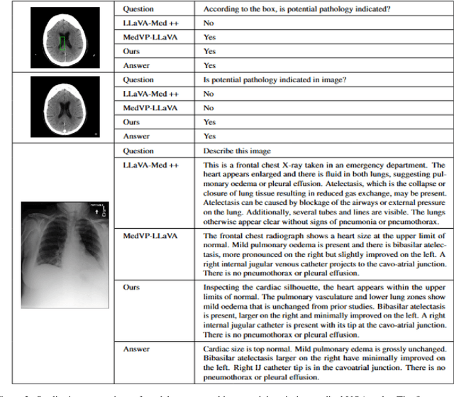 Figure 4 for MedCLM: Learning to Localize and Reason via a CoT-Curriculum in Medical Vision-Language Models