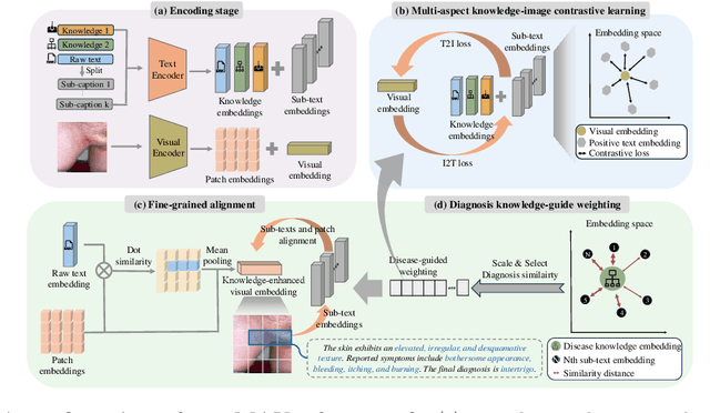 Figure 3 for MAKE: Multi-Aspect Knowledge-Enhanced Vision-Language Pretraining for Zero-shot Dermatological Assessment