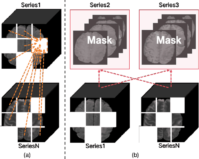Figure 3 for Enhanced MRI Representation via Cross-series Masking
