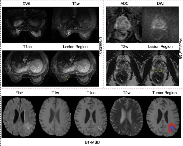 Figure 4 for Enhanced MRI Representation via Cross-series Masking