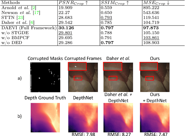 Figure 2 for Depth-Aware Endoscopic Video Inpainting