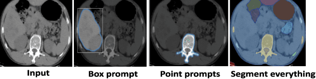 Figure 1 for Test-Time Adaptation with SaLIP: A Cascade of SAM and CLIP for Zero shot Medical Image Segmentation